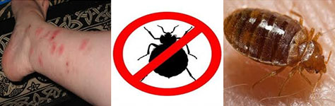 BED BUGS | BEDBUGS | BED BUG CONTROL